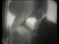 ZKA4t : Eye Saw Rain Squaw