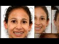 2008 Footlocker Championships
