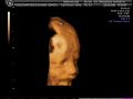 Ana, la sobrina de El Kinino a las 22 semanas de gestación Ana, la sobrina de El Kinino a las 22 semanas de gestación