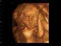 4D Baby sonogram