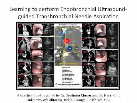 how to perform bronchoscopy