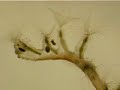 colonial freshwater hydroid (Cnidarian) colonial freshwater hydroid (Cnidarian)