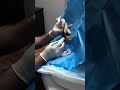 David's back surgery