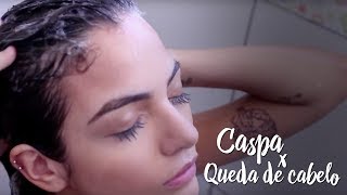 Caspa x Queda de cabelo