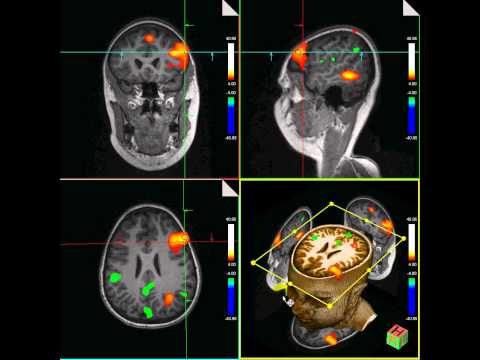 how to perform fmri
