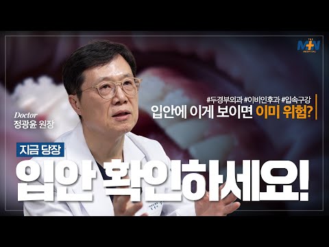 지금 당장 입 안을 확인해보세요! 구강암일까? 단순 염증일까?..