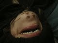 Chinder chin and Georgeretta in Hyper Chins
