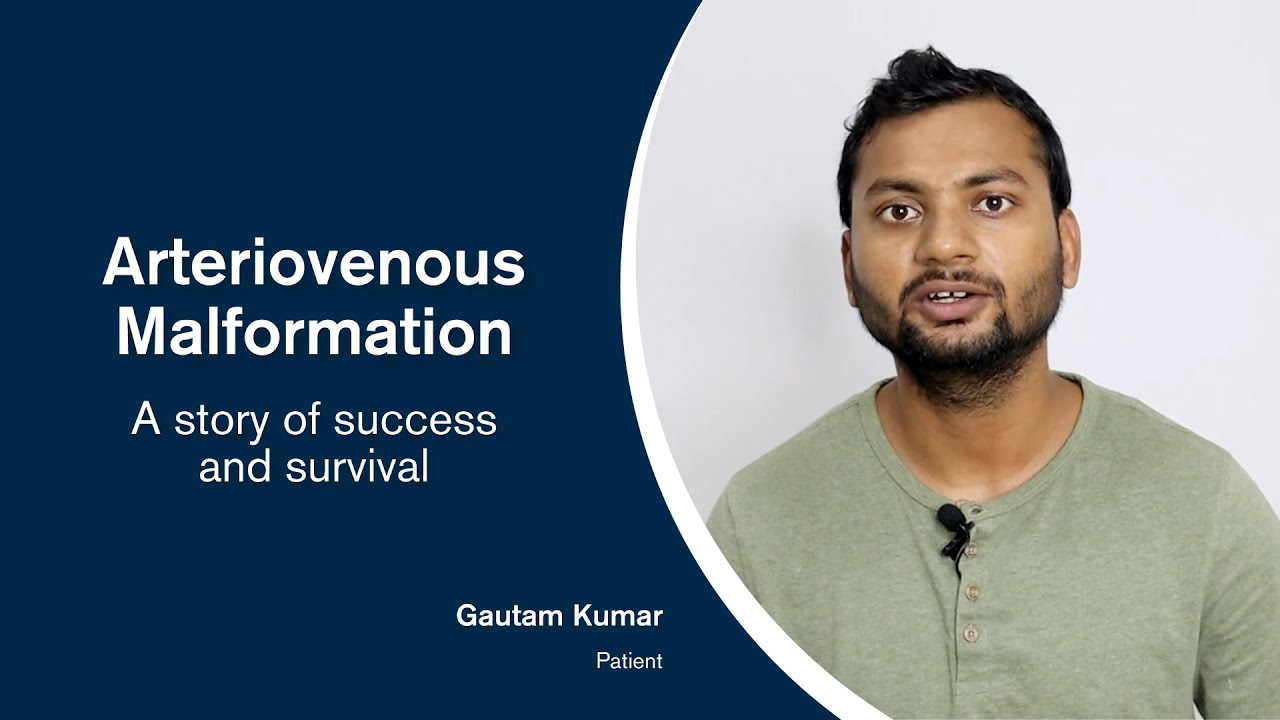 Arteriovenous Malformation - A Story of Success and Survival | Kamineni Hospitals