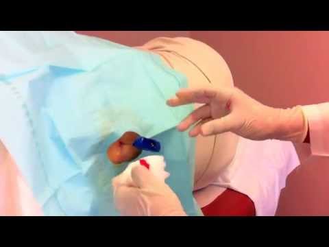 how to perform bone marrow biopsy