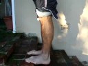 Ruptured Achilles Tendon stretch Achilles tendon rupture