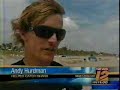 Shark Bite Recorded Live on the Beach