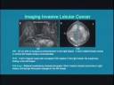 Naviscan High Resolution Organ Specific PET Scanner