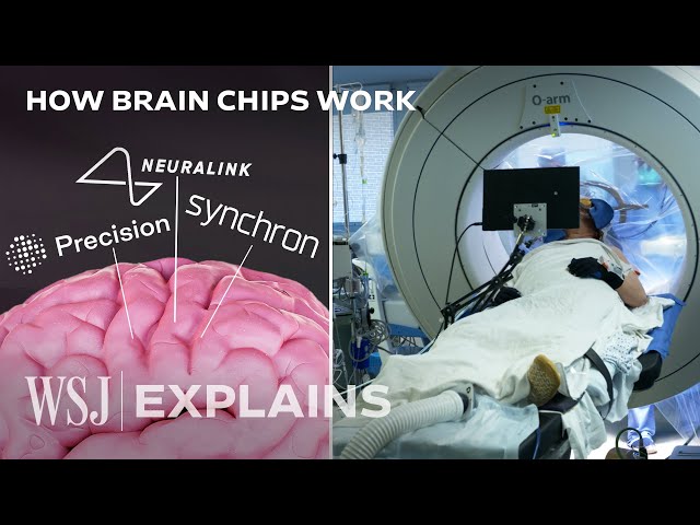 Neuralink’s Rival Tests Brain Chip in Race to Bring Implants to Market | WSJ