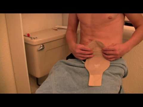 how to provide ostomy care