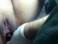 Natural Final Vaginal Stage Labor Childbirth - Episiotomy.