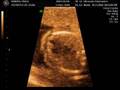 eco21.wmv