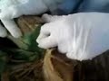 higado y vias biliares higado y vias biliares