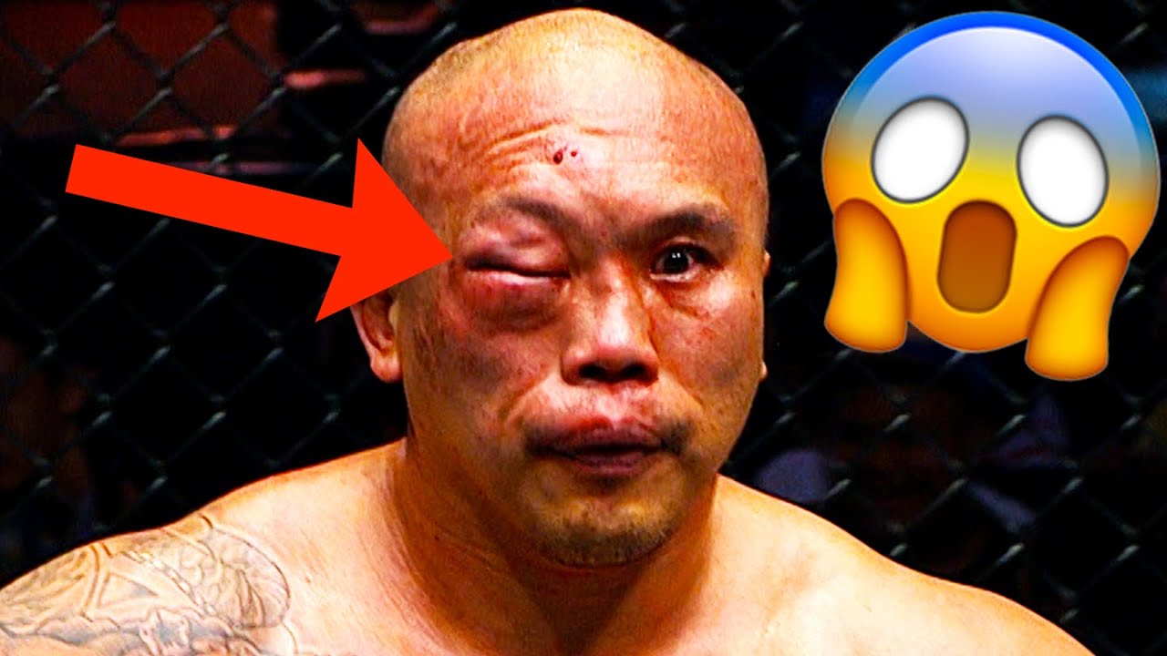 WHAT A COMEBACK 😱 Paul Cheng vs. Mahmoud Hassan Was UNBELIEVABLE