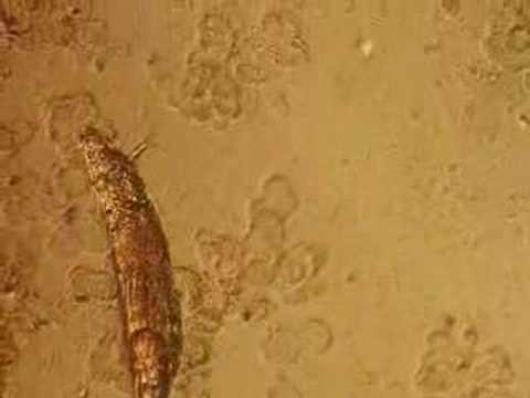 Rotifera Bdelloid
