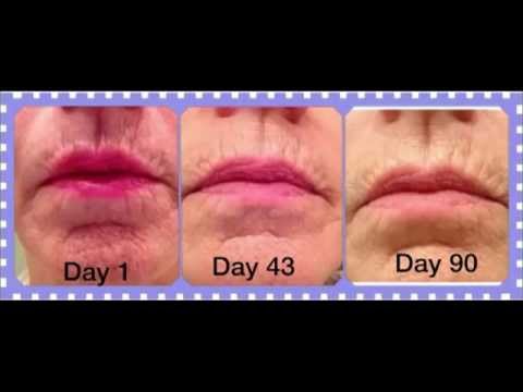 how to get rid wrinkles around mouth