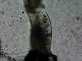 The Wild Paramecium
