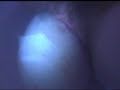 Baby Born at Baby Love Birth Center in Cape Coral, FL. The 