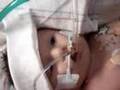 CDH awareness In loving memory of Drake Michel