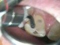 Thumbnail #1