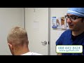 Dr. Behnam Explains FUE