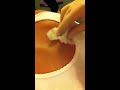 Lancing a cyst