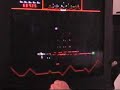 Williams Defender came out in 1980, 60000 games were made. This game is still one of the fastest paced games ever. When it came out people thought that it was no possible to pass 70k, later folks would be turning the game over. This is Red version MAME its on a tougher setting than most arcades would set it at. After 100k if you hang around for for over 10-20 secconds and waist time its not uncommon to get 5+ vaders on the screen. This is using the original panel with a Hagstrom keyboard ...