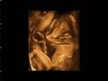 Joyan's baby video clip5