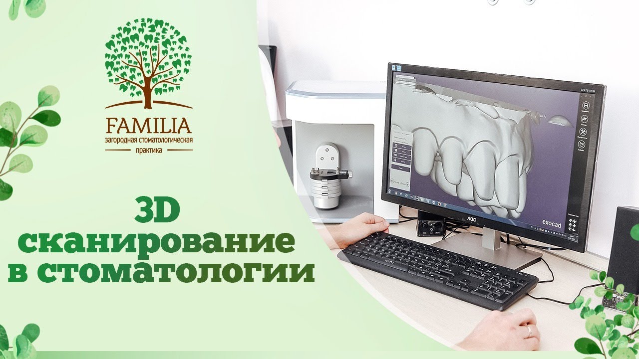 Цифровое 3D сканирование зубов в стоматологии Familia