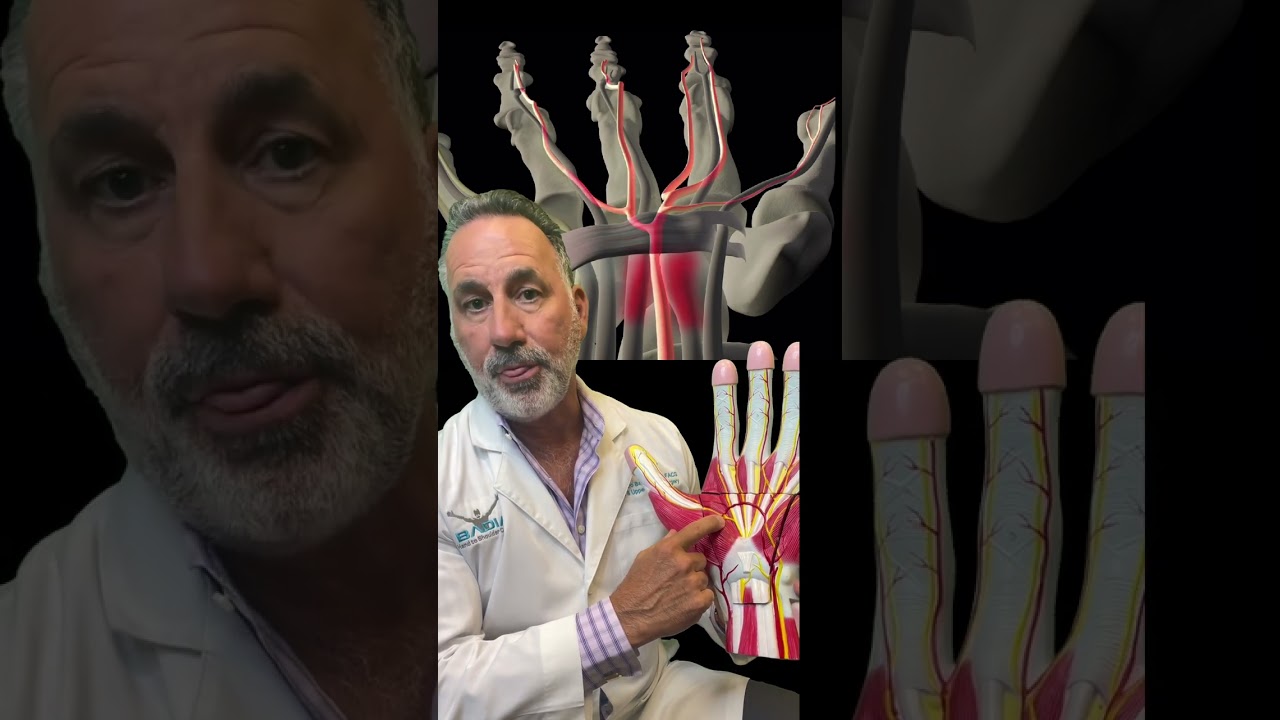 Do you have carpal tunnel syndrome ?