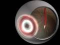 The Eye and sight process
