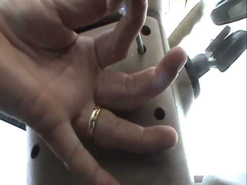 how to remove ignition