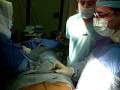 Abdominoplasty,liposuctin,vaginoplasty,labioplastyالتجميل,قطر,دبي, جراحة,,
