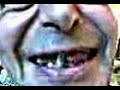 Thumbnail #1