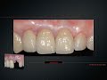 Surigcal Sulotion for Esthetic Problems