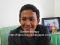 Stammering Stuttering Therapy - Terapi GAGAP