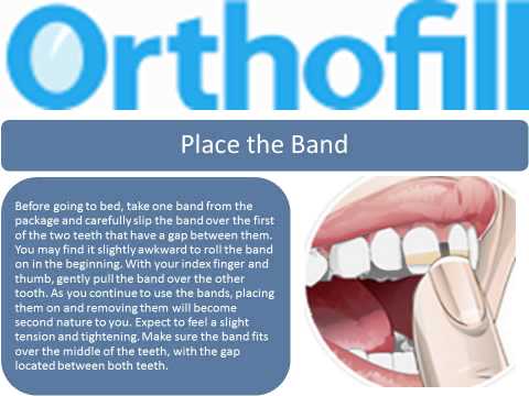 how to fill gaps between teeth