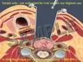 3D/2D Medical Animation: Anterior Cervical Fusion