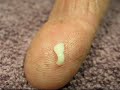 Tapeworm segment
