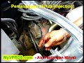 Alat Penjimatan Minyak MyVPROS (Injection)