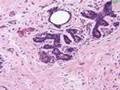 Histología - Glándula mamaria inactiva