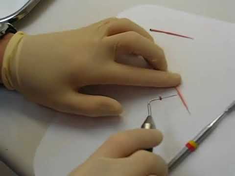 How to Join Gutta-Percha Cones