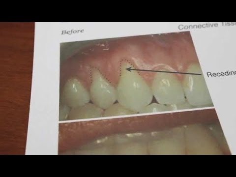 how to care sensitive teeth