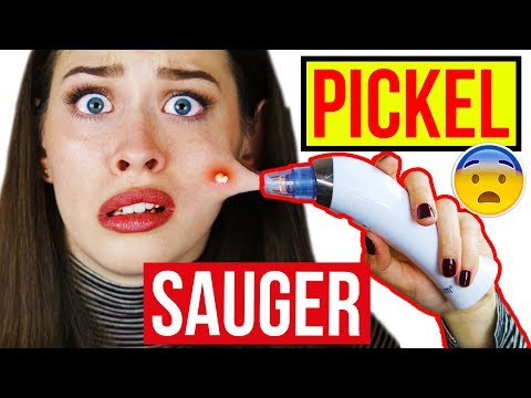 PICKEL ABSAUGEN mit PORENREINIGER! 😱 HEFTIGER VAKUUM SAUGER!