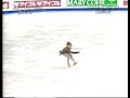 TOE Loop TOE Loop
