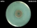 MRSA - Zonex